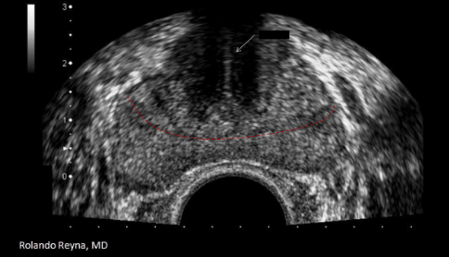 <p>Urethra</p>