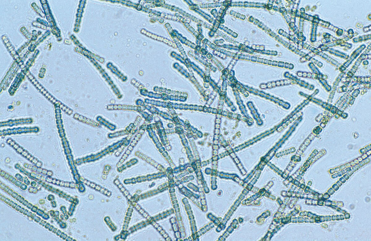 <p>Cyanobacteria</p>