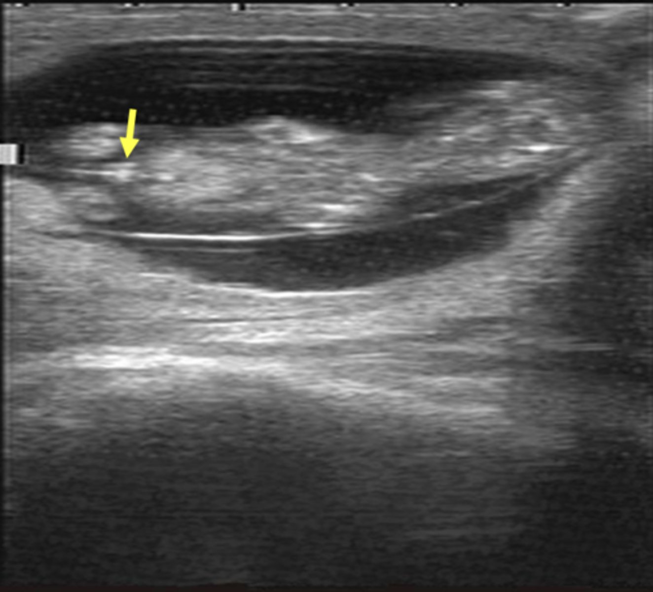 <p>What sex is the fetus (bovine)?</p>
