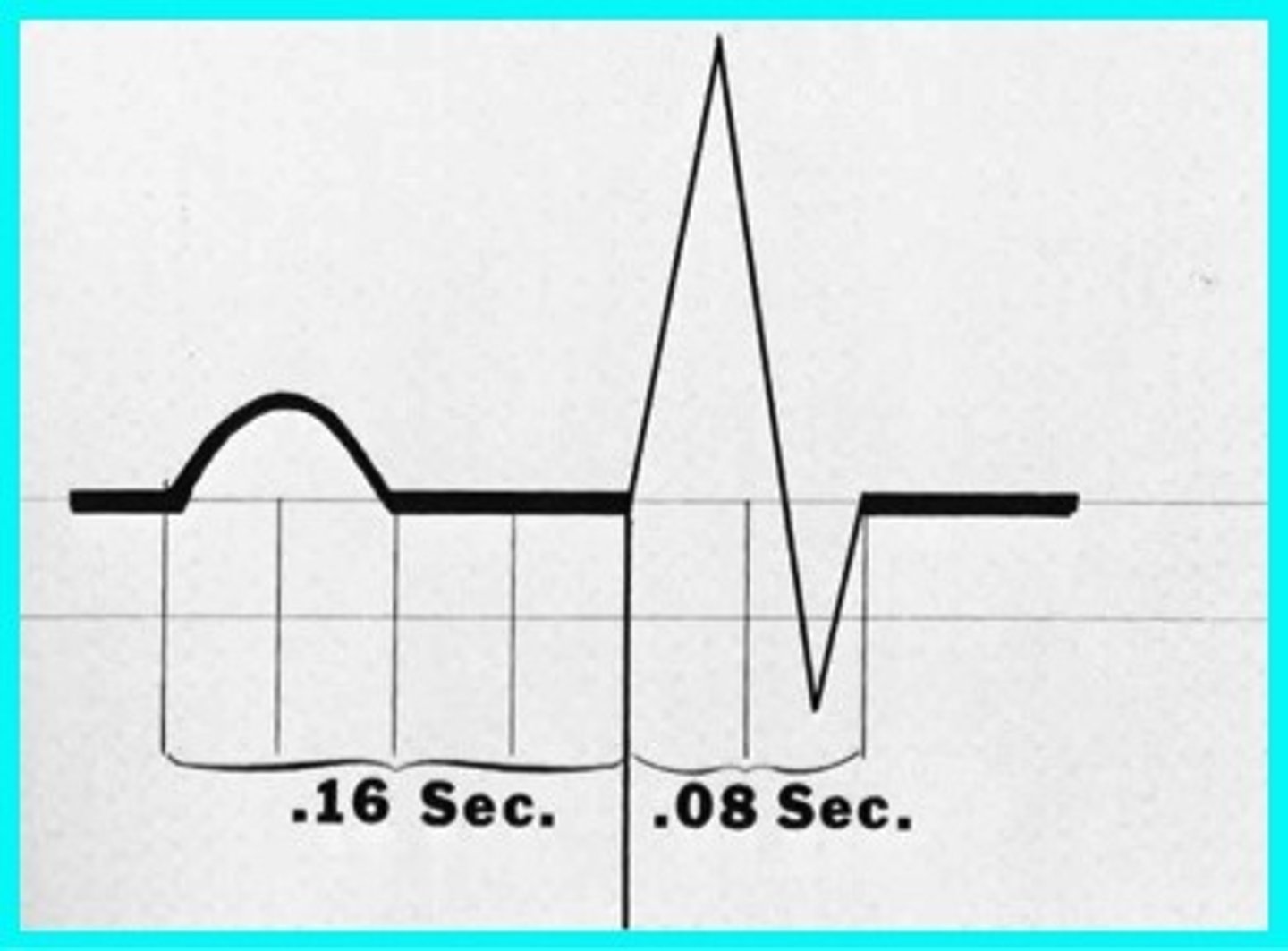 <p>length of time for ventricles to depolarize; atrial re-polarization occurs at the same time</p>