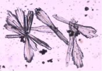<p>Calcium phosphate</p>