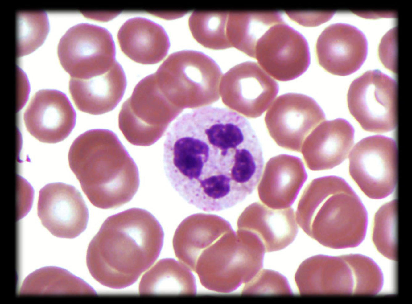 <p>What leukocyte is this?</p>