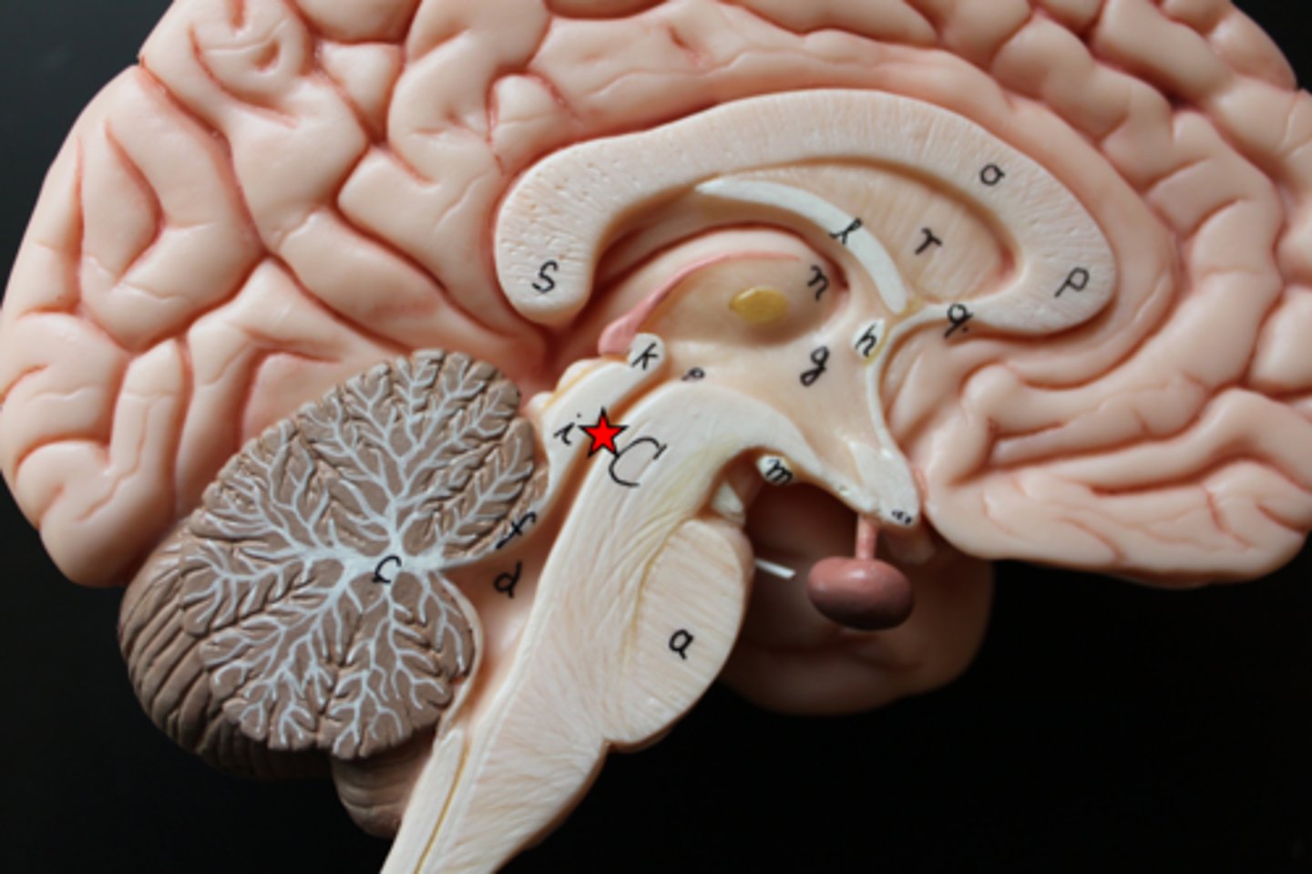 <p>connects third and fourth ventricles</p>