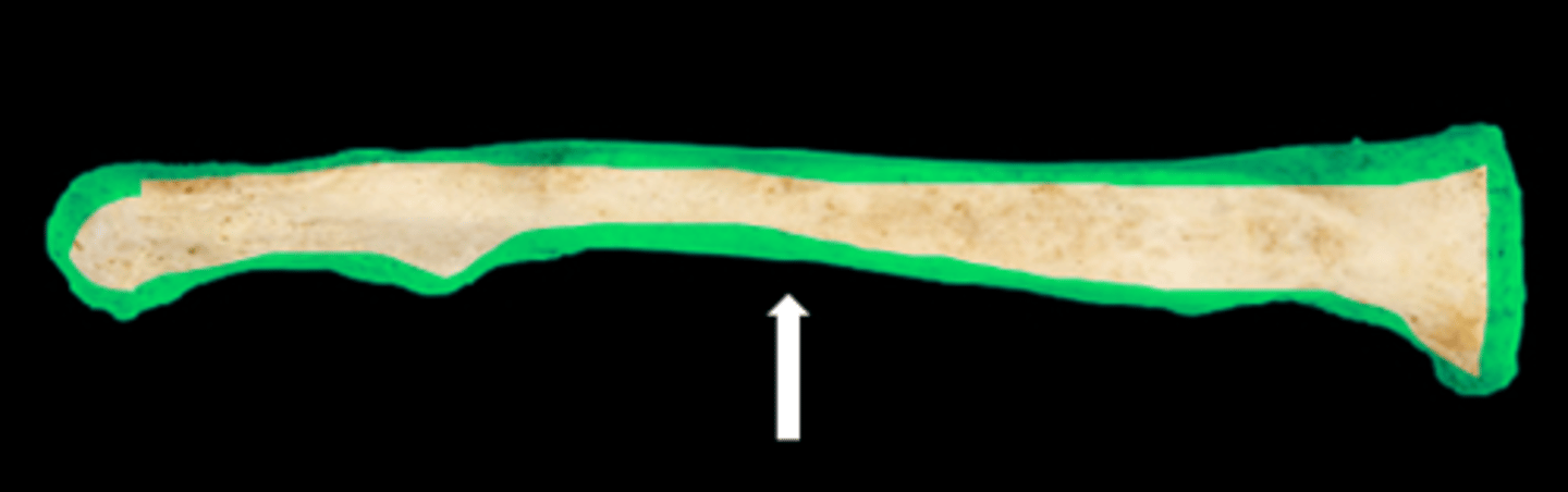 <p>name the bone</p>