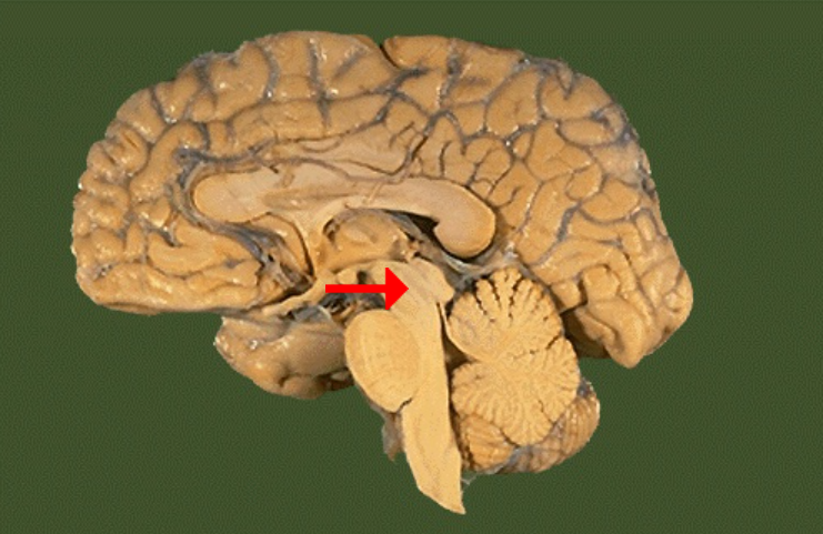 <p>Label this brain part</p>