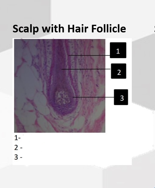 <p>Label all terms</p>