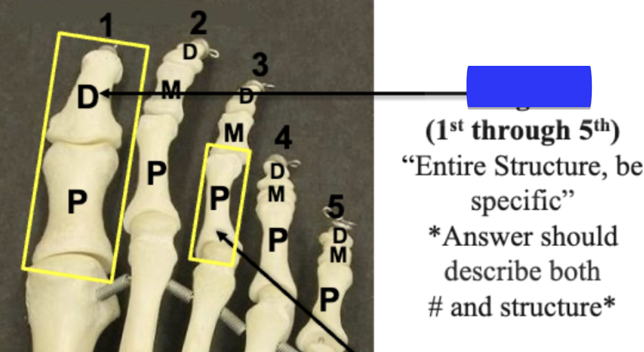 <p>Entire structure, be specific </p>