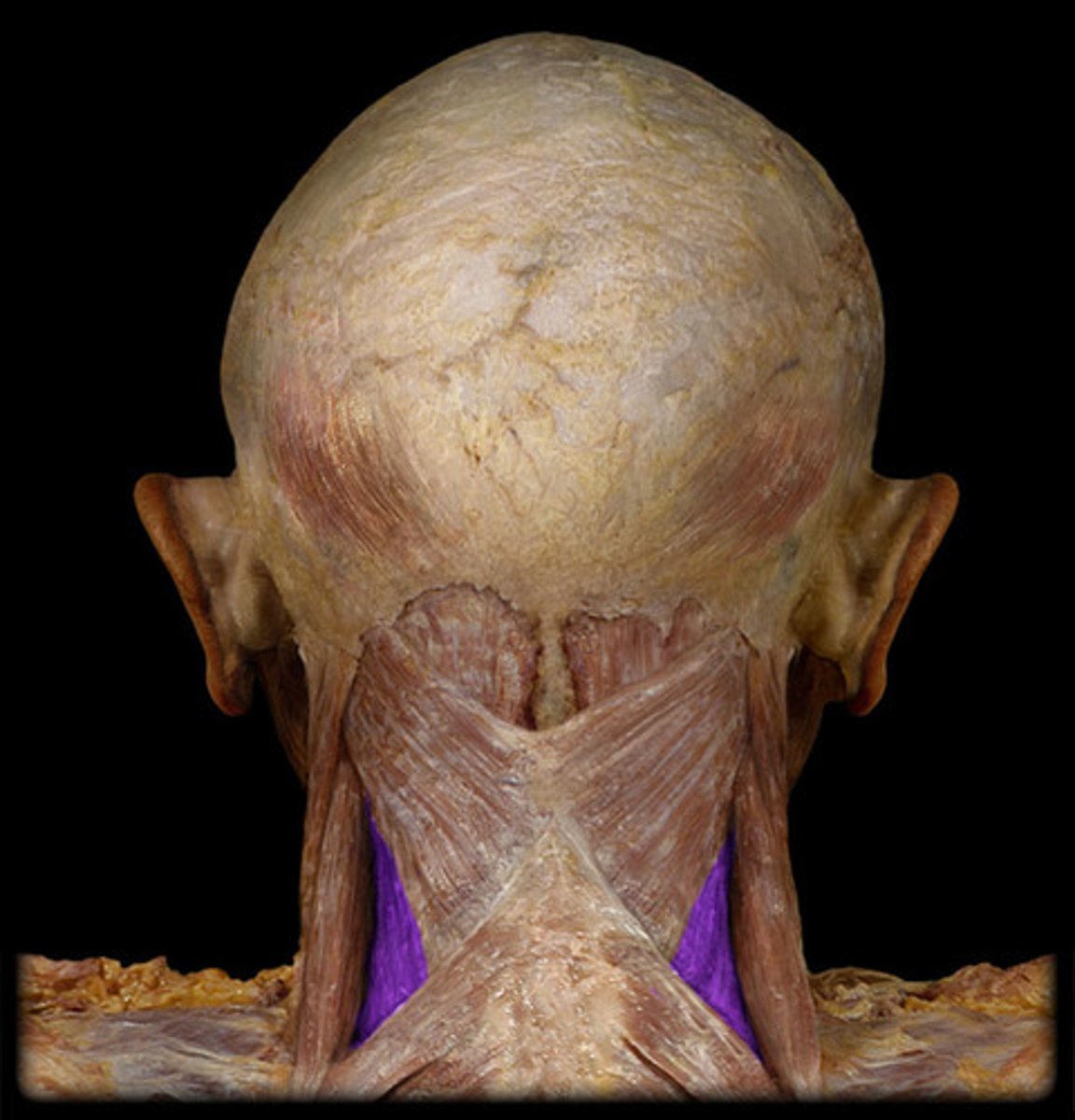 <p>Extend neck/laterally flex and rotate head to same side</p>