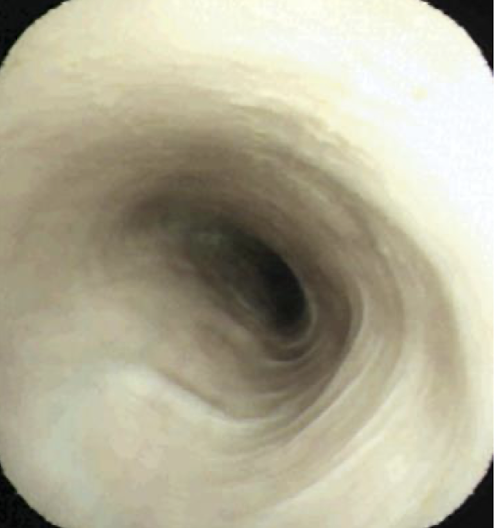 <p>What part of the esophagus is this? </p>