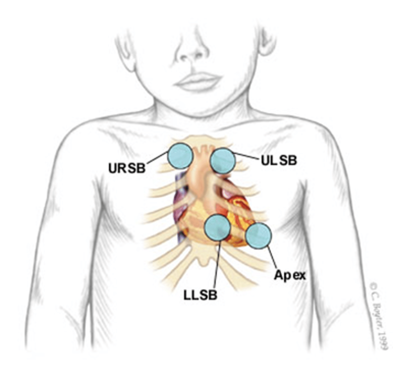 <p>80-160 bpm<br>apical pulse @ 3-4 rib to left (medial) to midclavicular line<br>monitor for full 60 sec</p>