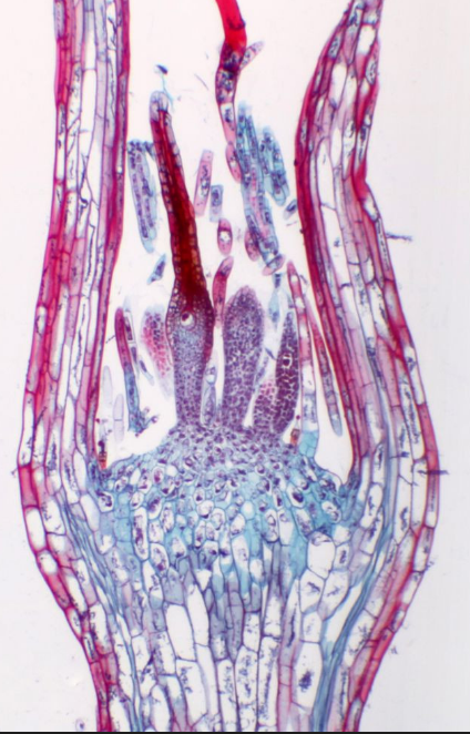 <p>Vad kollar du på, och från vilket fylum? Vad är funktionen av det du kollar på? Peka ut anteridier och spermatogen vävnad</p>