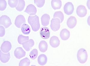 Early schizont plasmodium malariae