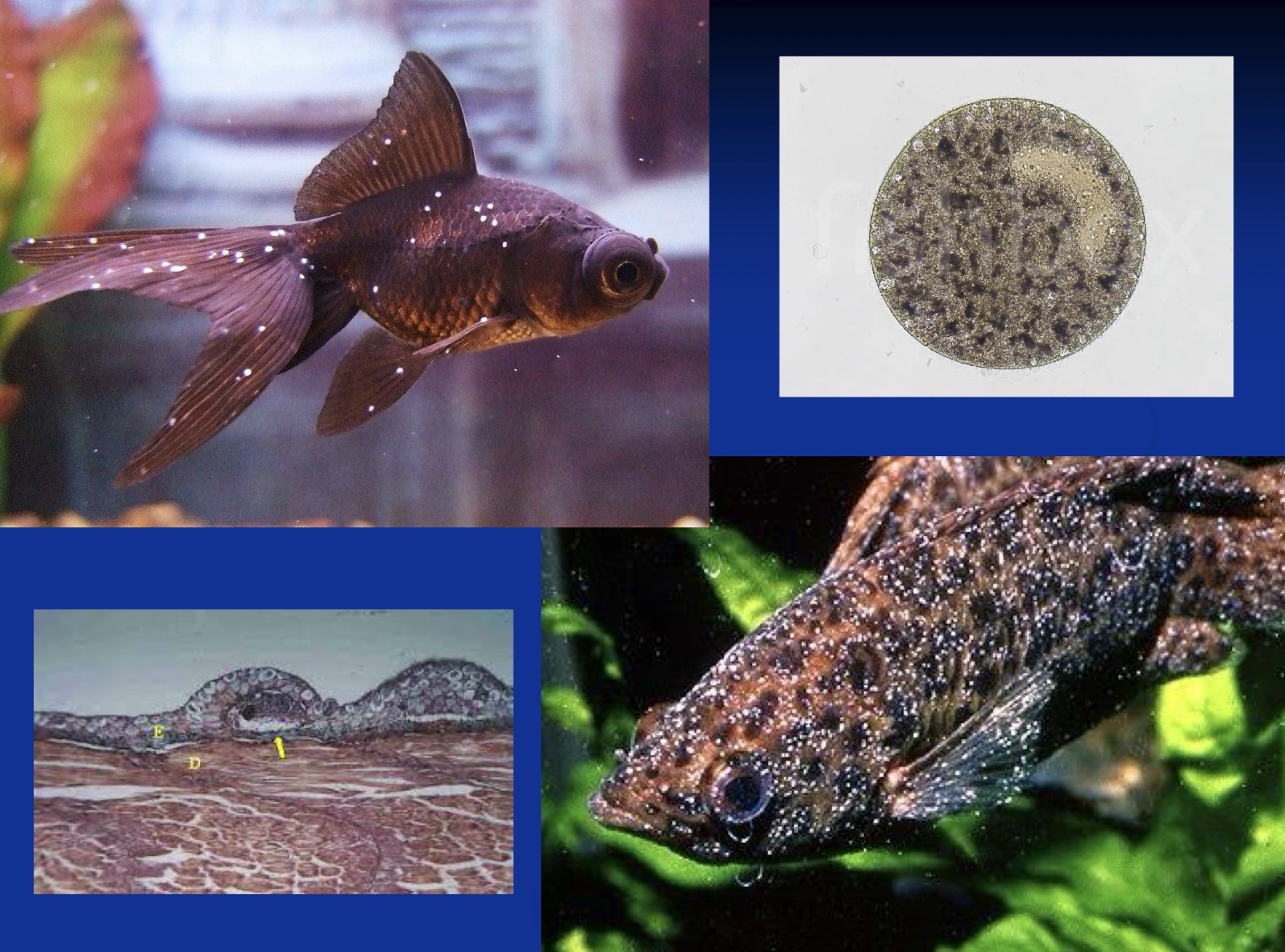 <p><strong>Freshwater White Spot Disease (Ich)</strong></p><p><strong>Causative agent:</strong><br><strong><mark data-color="red" style="background-color: red; color: inherit;">Ichthyophthirius multifiliis</mark></strong><mark data-color="red" style="background-color: red; color: inherit;"> </mark>(ciliate protozoan)</p><p><strong>Hosts:</strong><br>Virtually <strong>all freshwater fish</strong><br>High risk: <strong>scaleless fish</strong> (e.g. catfish)<br>Outbreaks linked to <strong>stress</strong></p><p><strong>Localization:</strong><br>Skin and gill epithelium</p><p><strong>Life cycle:</strong><br><strong>Trophont</strong><span> (feeding stage inside nodules on skin/gills) → leaves host → </span><strong>Tomont</strong><span> (encysted, asexual division) → </span><strong>Tomites</strong><span> → motile </span><strong>Theronts</strong><span> (infective stage invading new host)</span></p><p><strong>Clinical signs:</strong><br>White/grey <strong>nodules ≤1 mm</strong>, fin & gill damage, respiratory distress,<span> suffocation, rubbing the body against objects</span></p><p><strong>Pathogenesis:</strong><br>Heavy infections → <strong>up to 100% mortality</strong></p><p><strong>Diagnosis:</strong><br>Typical white spots (± microscopy)</p><p><strong>Prevention / Therapy:</strong><br>Treat <strong>theronts</strong><br>↑ Temp <strong>>30 °C for ~7 days</strong>, <strong>formalin</strong>, <strong>toltrazuril</strong>, <strong>UV</strong><br>Daily vacuuming; cysts <strong>killed by drying</strong></p>