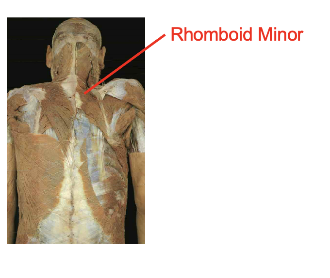 <p>Rhomboid minor</p><p></p><p>origin</p><ul><li><p>spinous process of C7-t1</p></li></ul><p>insertation</p><ul><li><p>root of spine of sclpula</p></li></ul><img src="https://knowt-user-attachments.s3.amazonaws.com/5ccf127d-f6dd-454e-b12e-917c144f8a64.png" data-width="100%" data-align="center"><p></p>