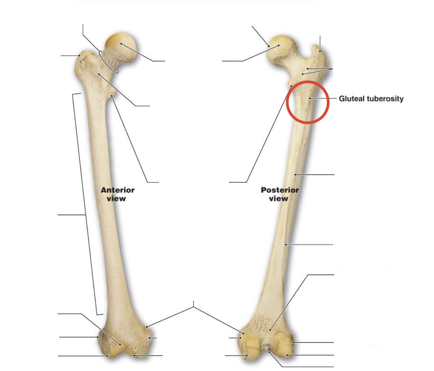 <p><span><span>Gluteal tuberosity</span></span></p>