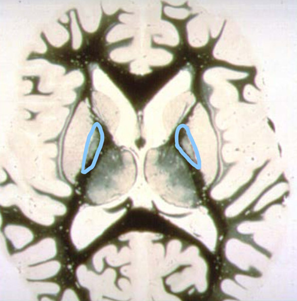 <p>identify the structure</p>