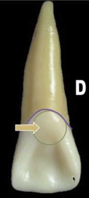 <p><mark data-color="blue" style="background-color: blue; color: inherit">maxillary central incisors #8 and #9; lingual fossa</mark></p>