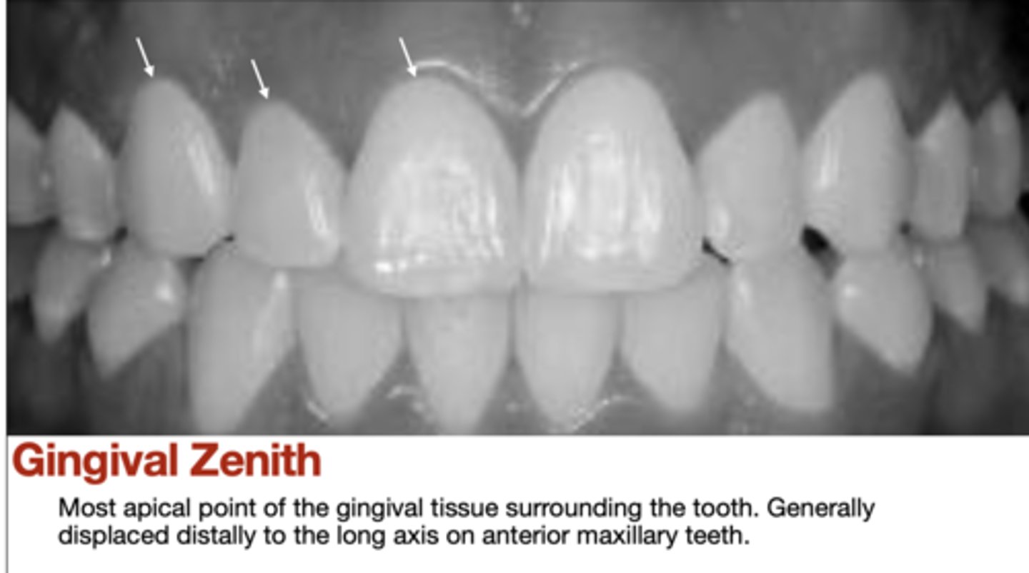 <p>gingival zenith</p>