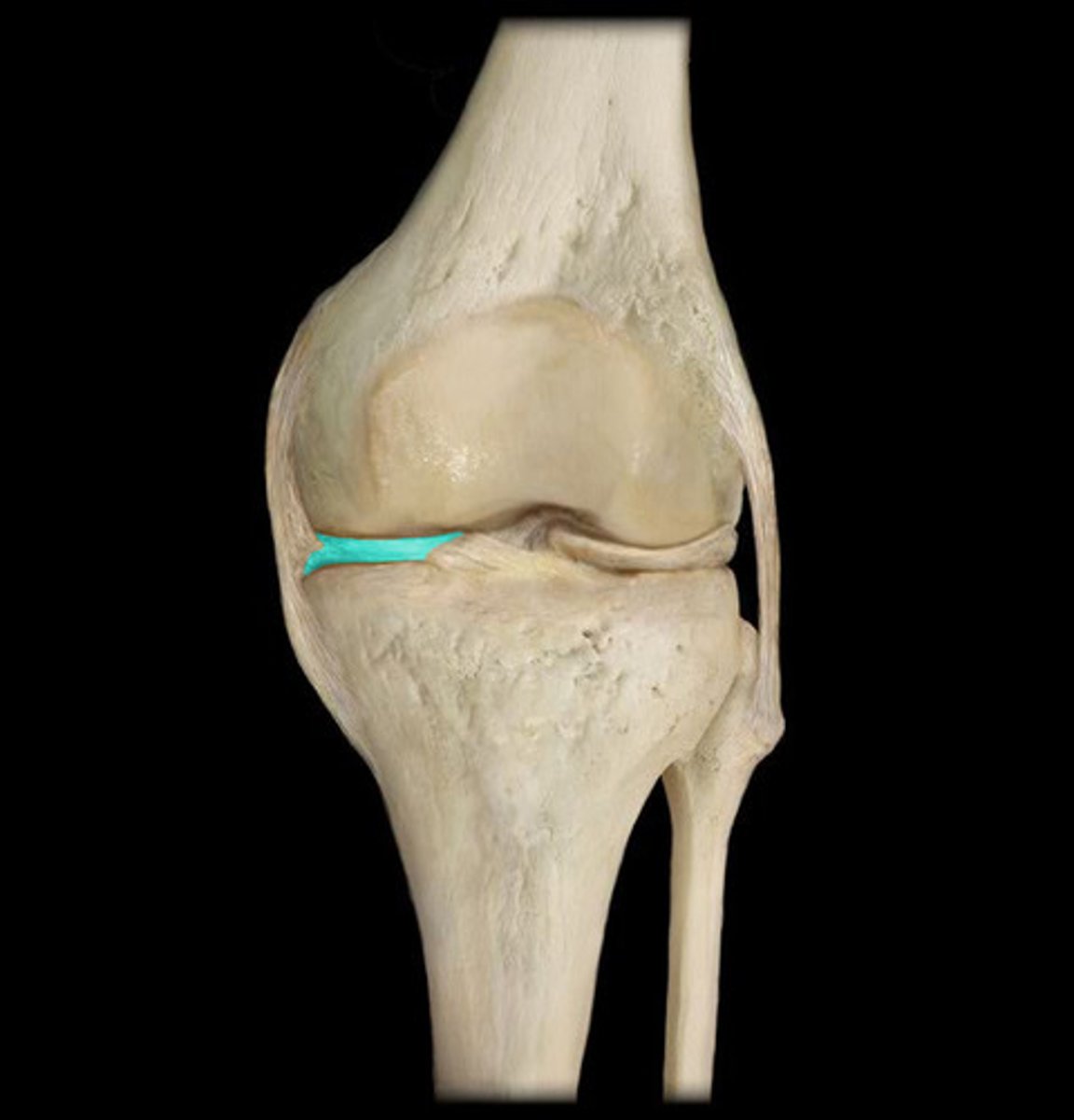 <p>Cartilage cushioning the knee joint</p>
