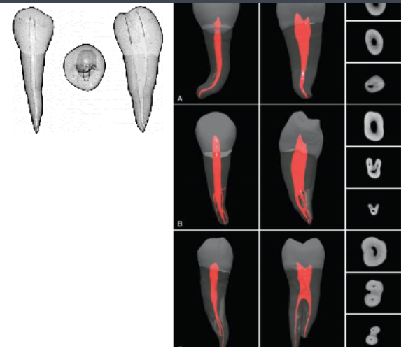 <p>1 root </p>