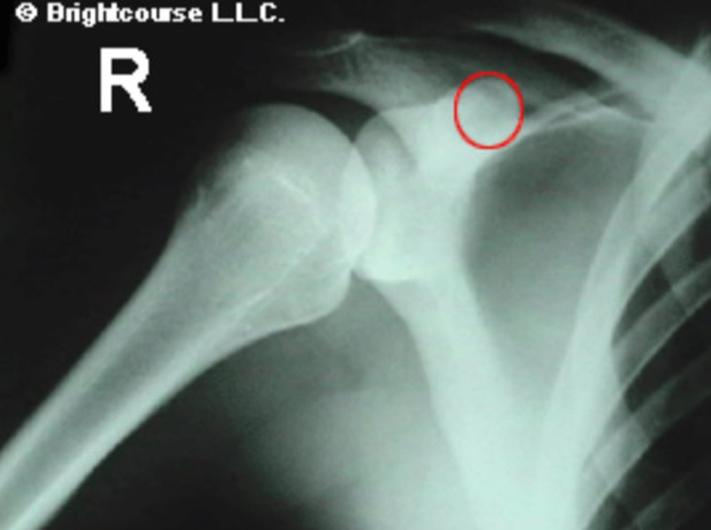 <p>What is being circled in the image?</p>