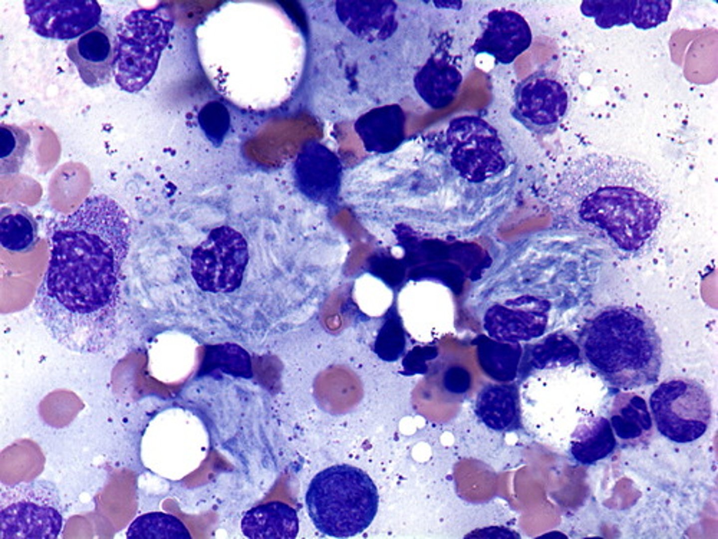 <p>histo of macrophage</p>