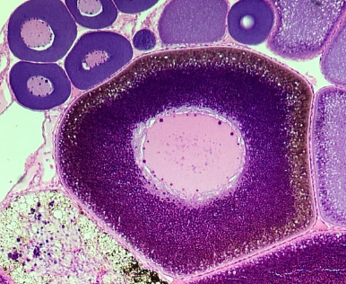 <p>What ovary specimen is this?</p>