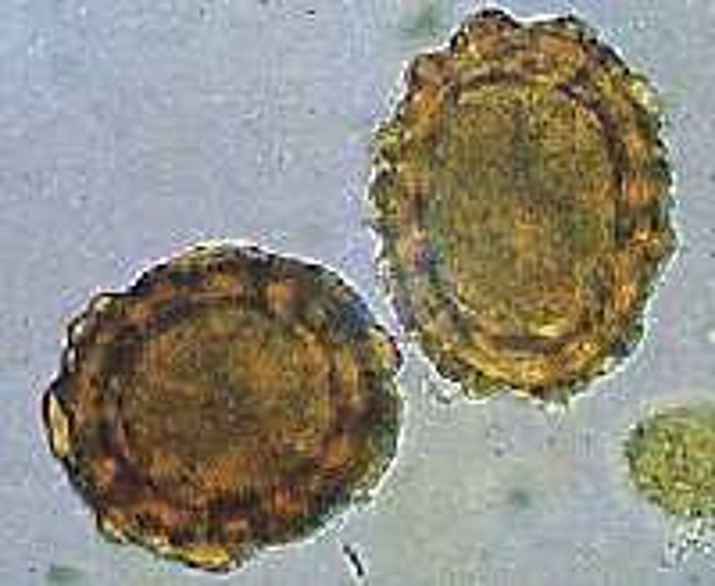 <p>- Size: ~62 x 45 μm</p><p>- Thick, mammilated shell</p><p>- Golden brown color</p><p>- Single-cell (uninfective) when passed</p><p>- Sticky albuminous coat</p>
