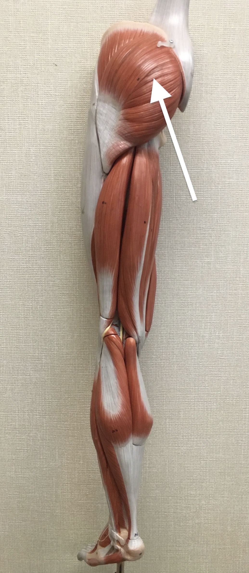 <p><span>Name the muscle labeled with the white arrow below AND name the origin .</span></p>