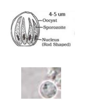 <p><em>Cryptosporidium</em></p>