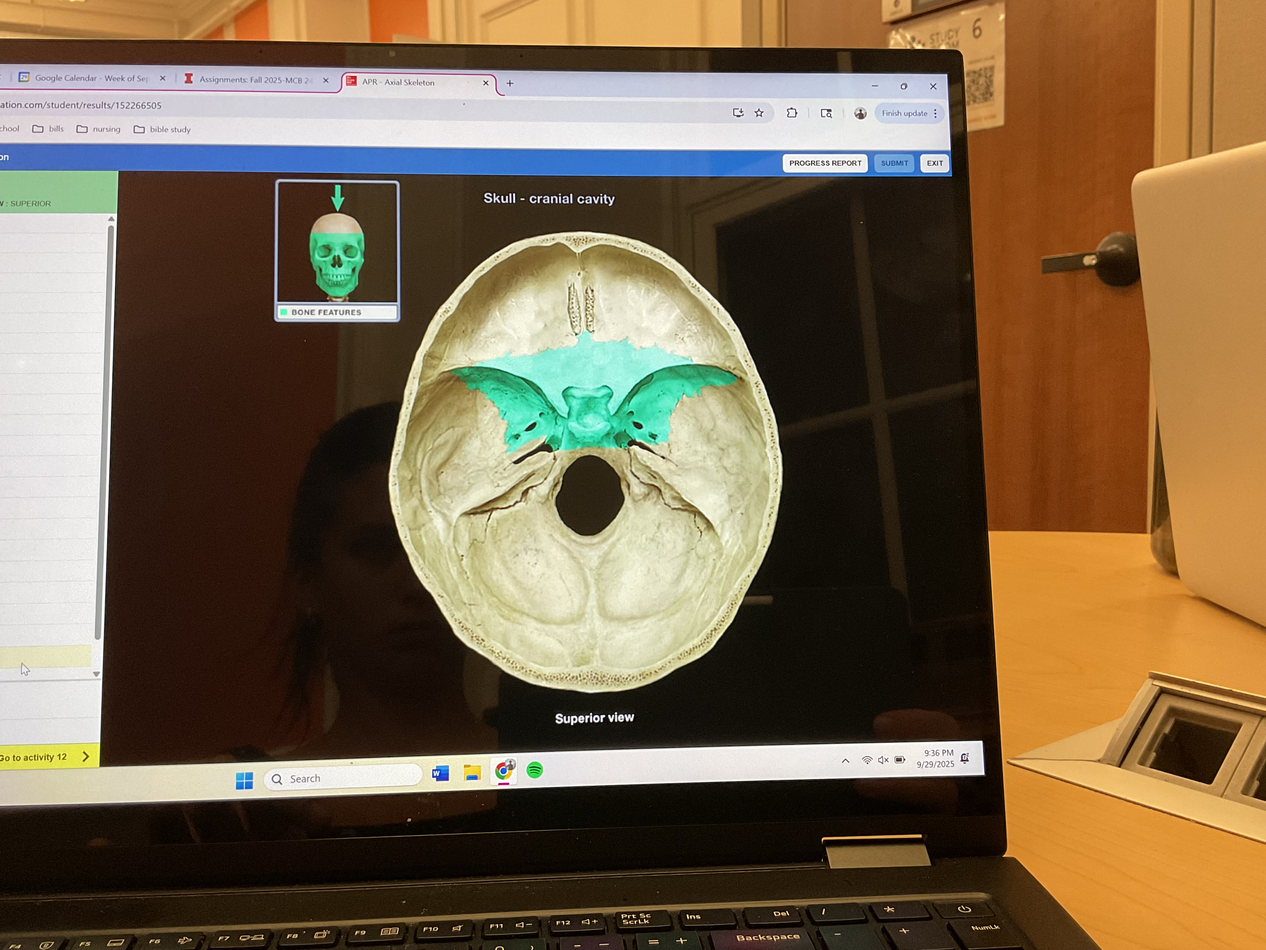 <p>Sphenoid bone</p>