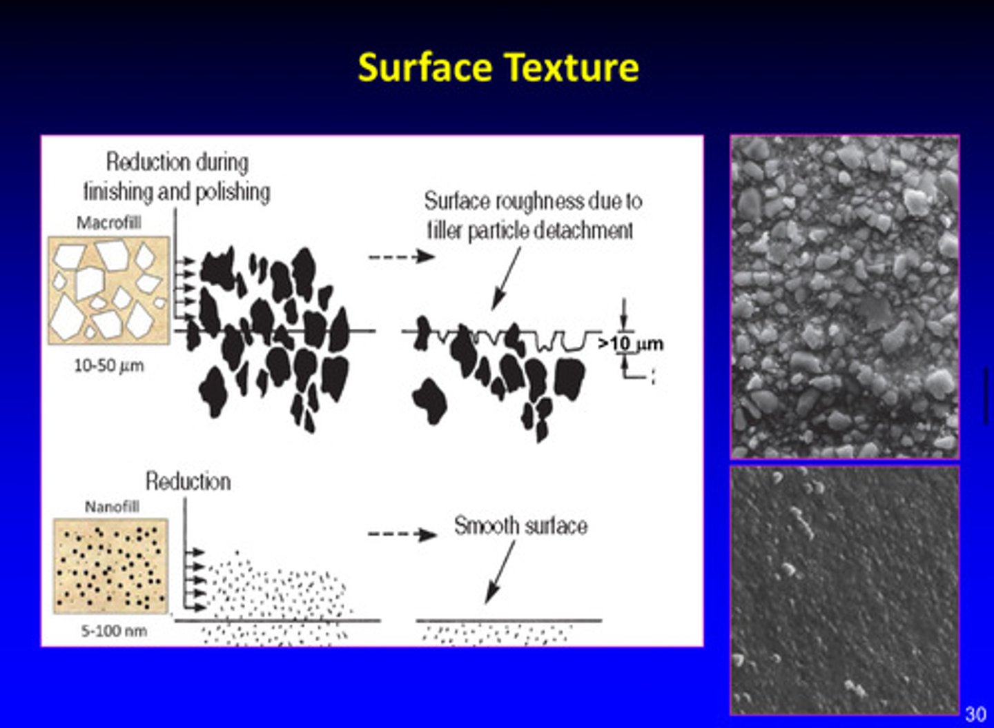 <p>there is surface roughness in macrofill material due to filler particle detachment; nanofill has smooth surface</p>