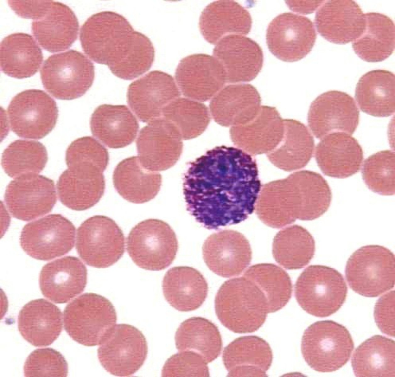 <p>white blood cell containing granules that stain blue; associated with release of histamine and heparin</p>