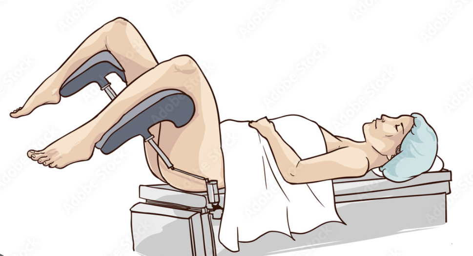 term image