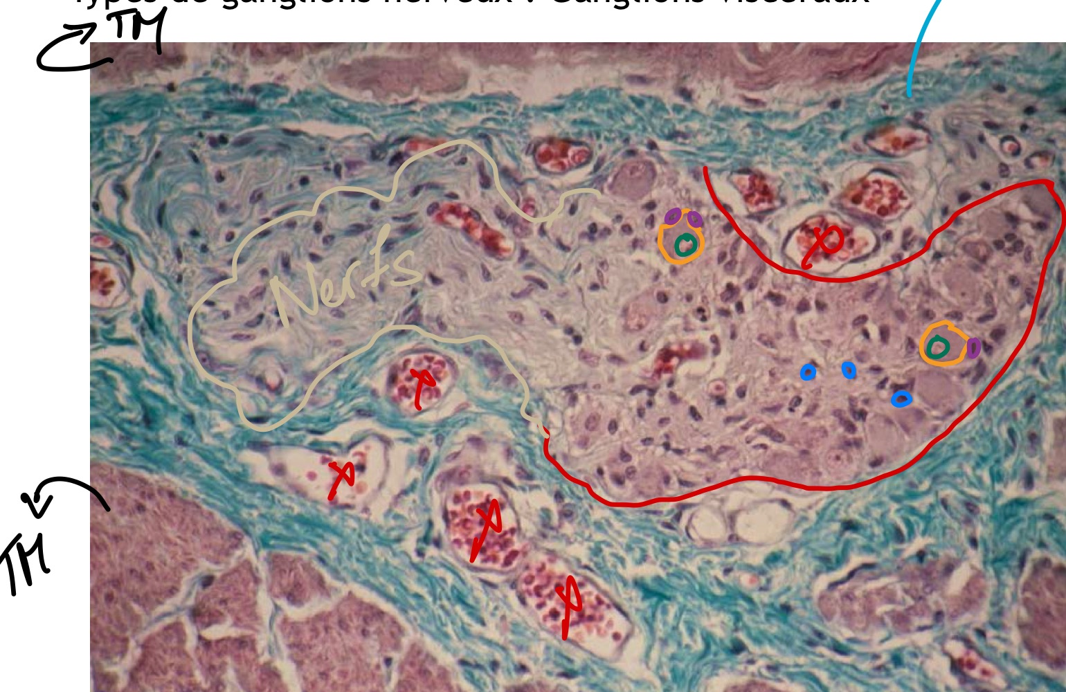 <p>MO, paraffine, TMB </p><p>Ganglions nerveux + nerfs </p><p>Tissus musculaire </p><p>→ plexus nerveux d’Auherback </p><p>TCNS dense irrégulier </p><p>ERU pavimenteux </p>