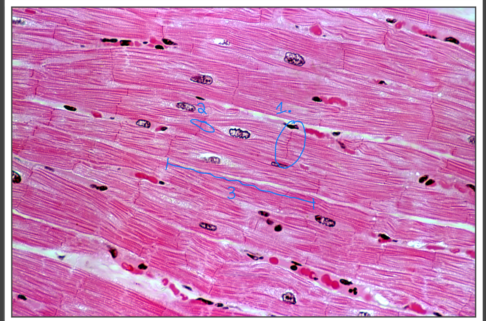 <p>What tissue is this </p>