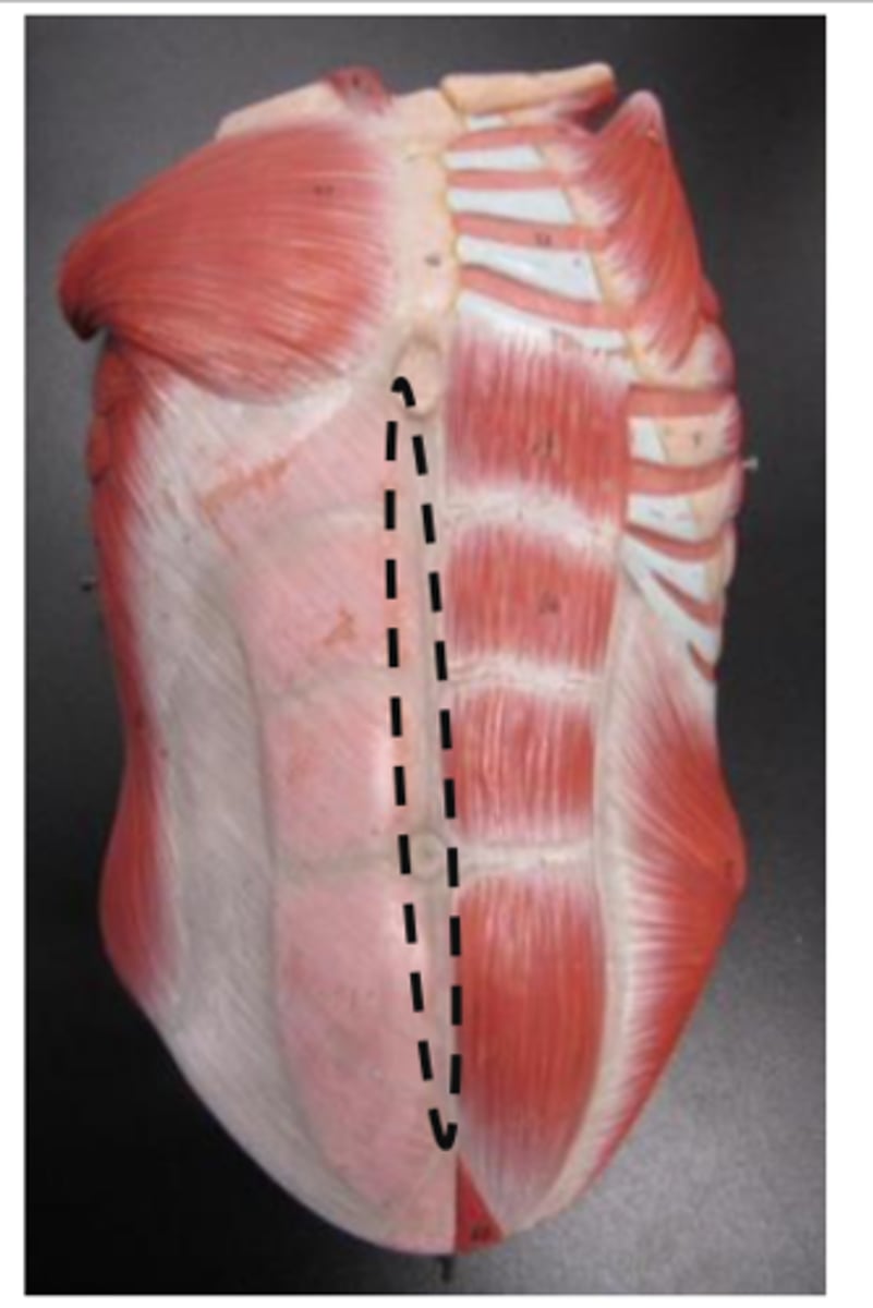 <p>line that goes straight down the abs and belly button</p>