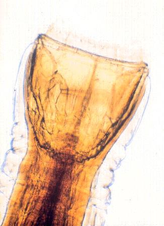 <p>Identify the Strongylus sp. depicted in this image.</p>