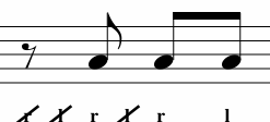 <p>What Variation is This? </p>