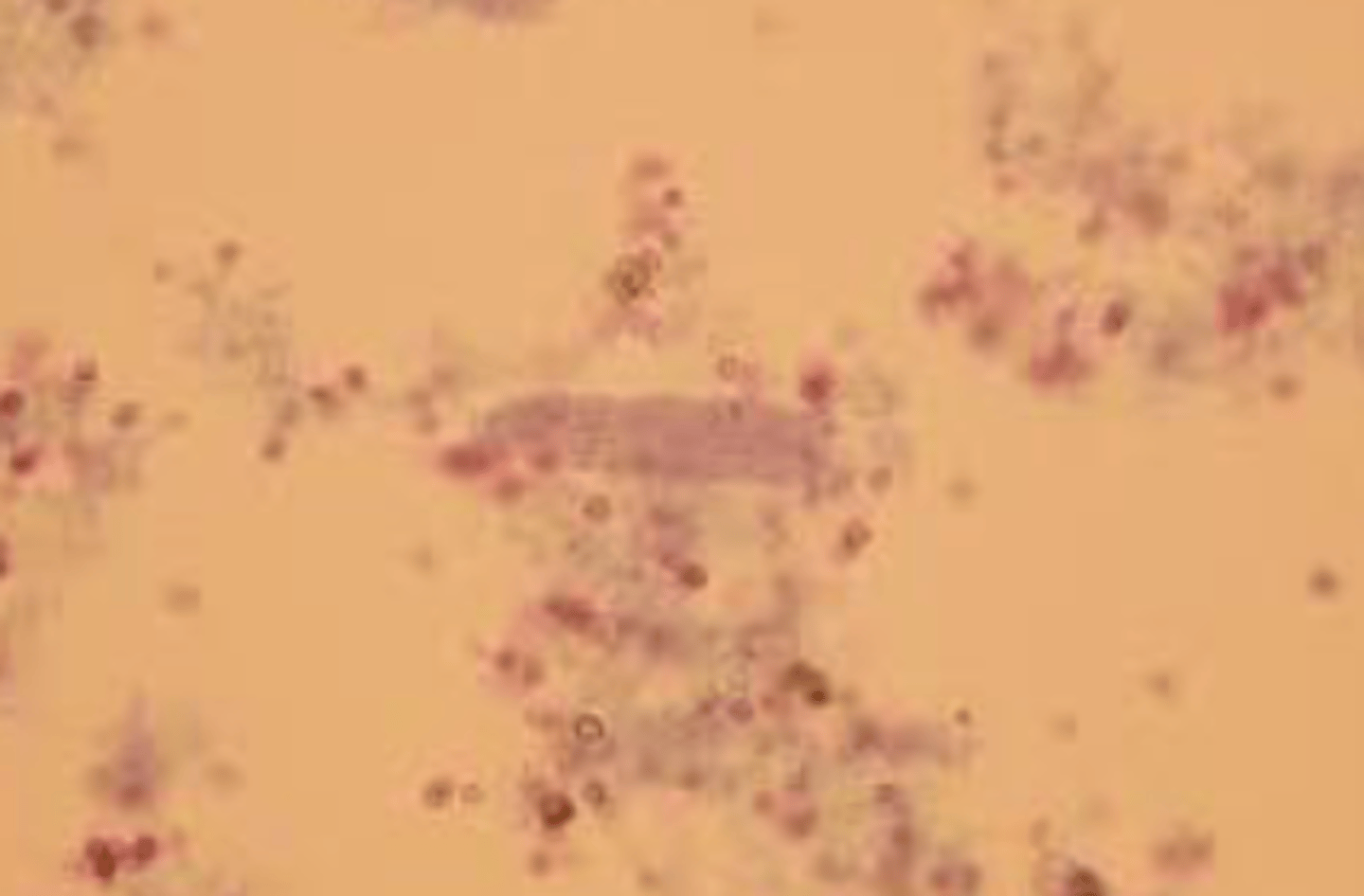 <p>- Most basic</p><p>- Clear, colorless, and highly refractile</p><p>- Parallel sides and rounded ends</p><p>- Can be easily obscured if light is up too high (have dim light)</p><p>- Low numbers are normal</p><p>- Seen with exercise or stress</p>