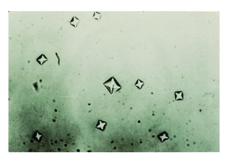 <p><span style="font-family: Arial, sans-serif">Calcium oxalate crystals</span></p>