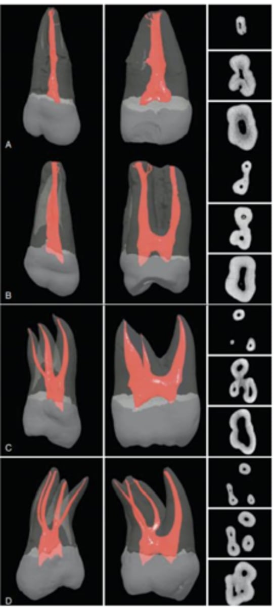 <p>20-40 (MB root has 4th canal usually, DB never)</p>