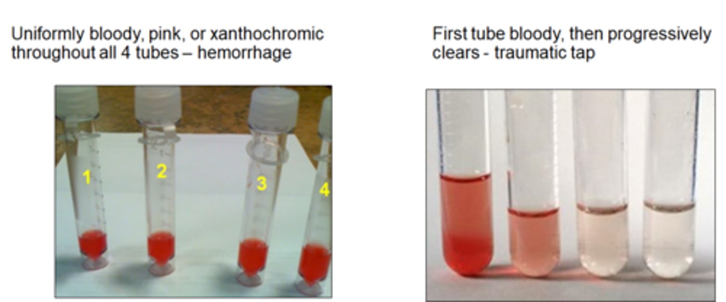 <p>blood contamination</p><p>neck stiffness</p><p>infection</p><p>brain hemorrhage</p>