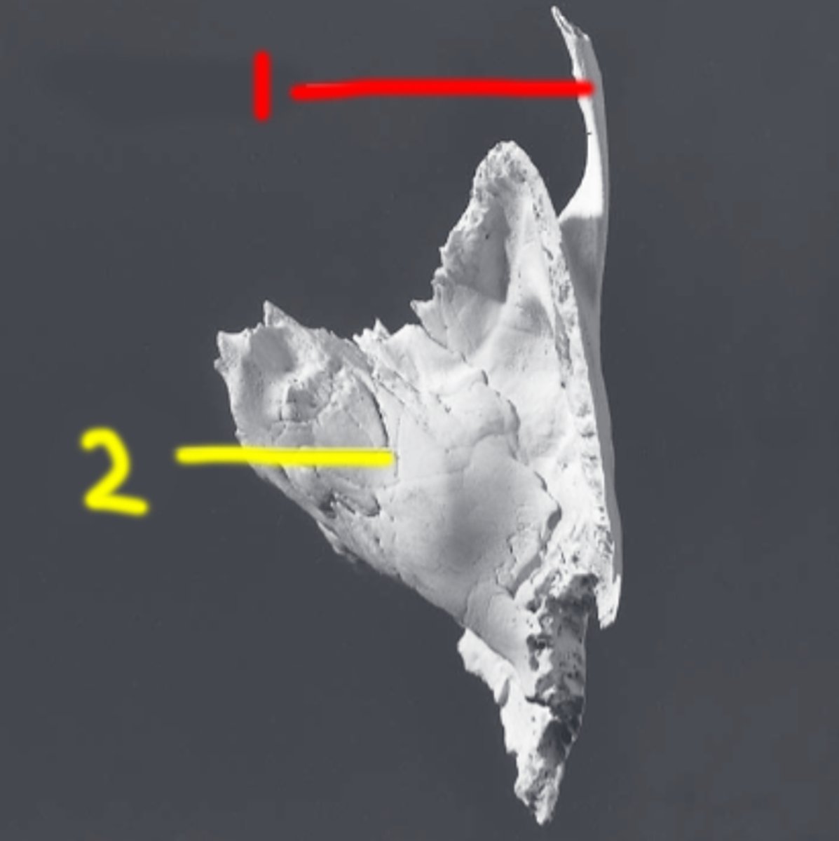 <p>massive, dense bony part of TEMPORALS that houses ear ossicles, wedged between OCCIPITAL and SPHENOID</p>