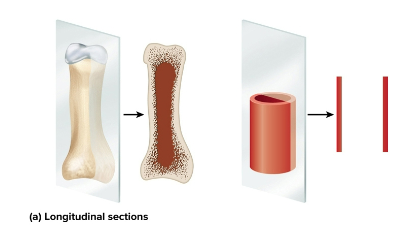 <p>Longitudinal section</p>
