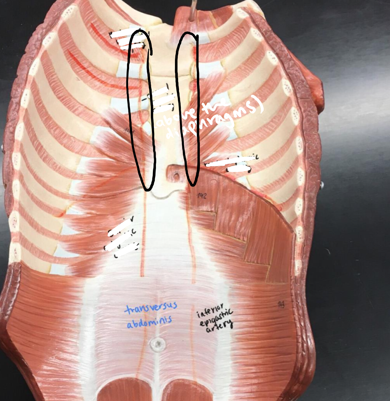<p>Red lines above the diaphragms</p>
