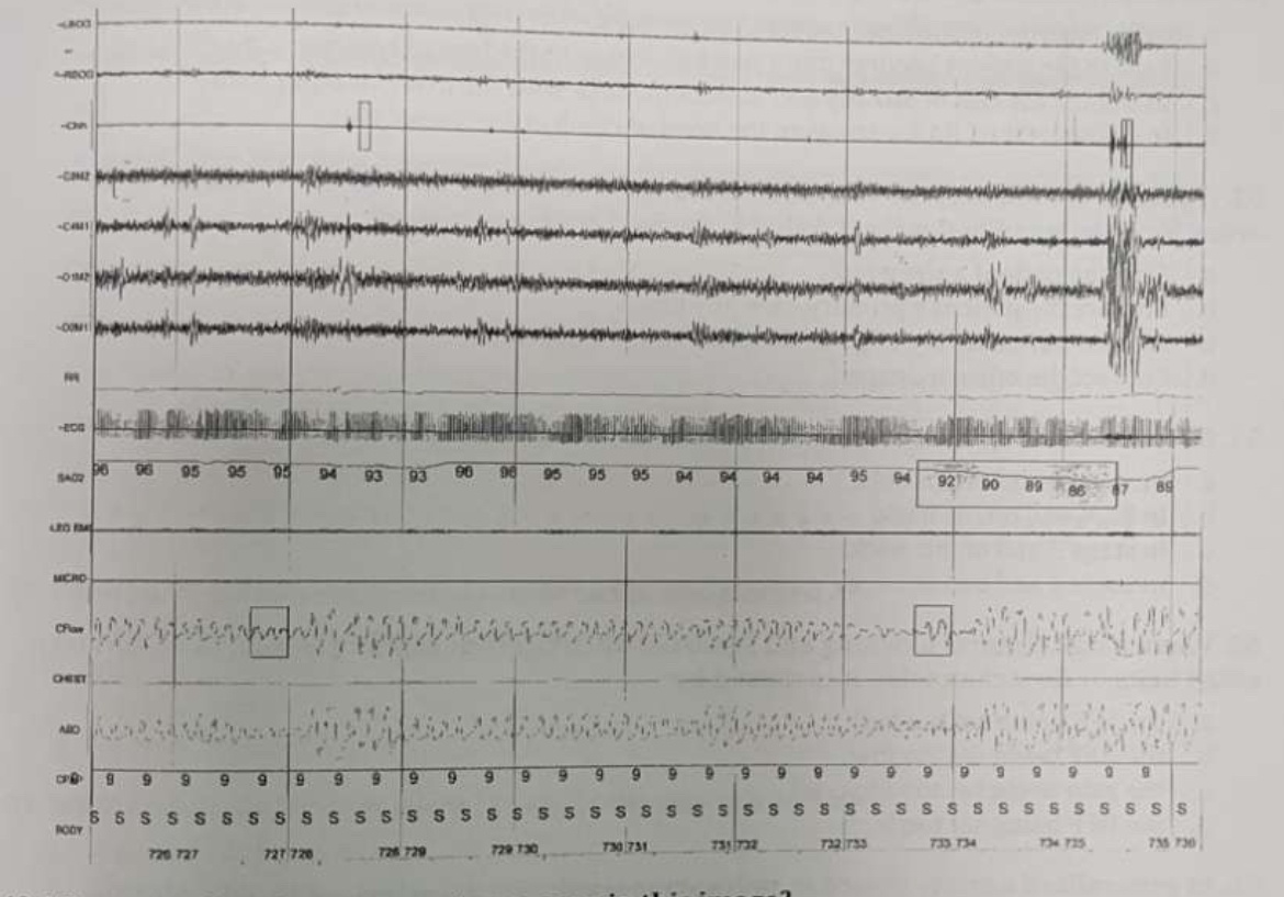 <p><span>How should the technician treat these respiratory events?</span></p>