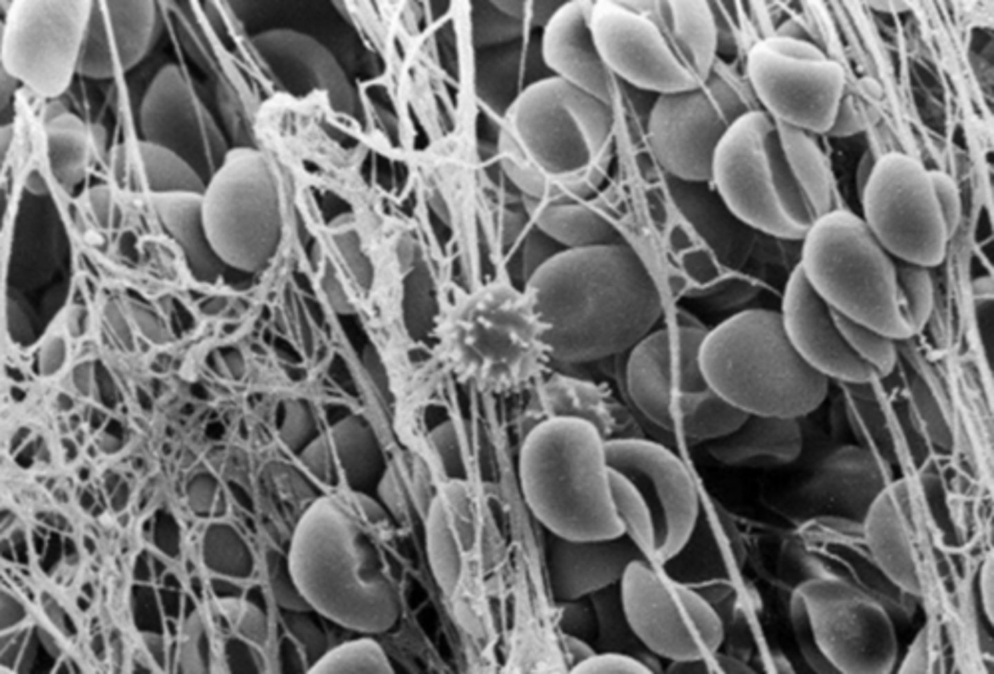 <p>Conditions that increase clot formation within arteries or veins</p>