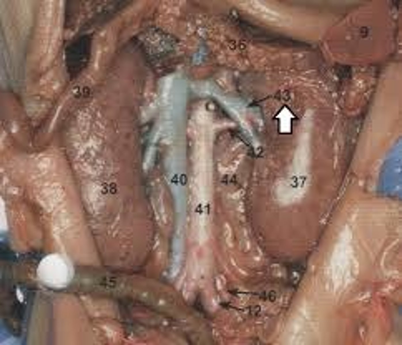 <p>out of kidney</p>