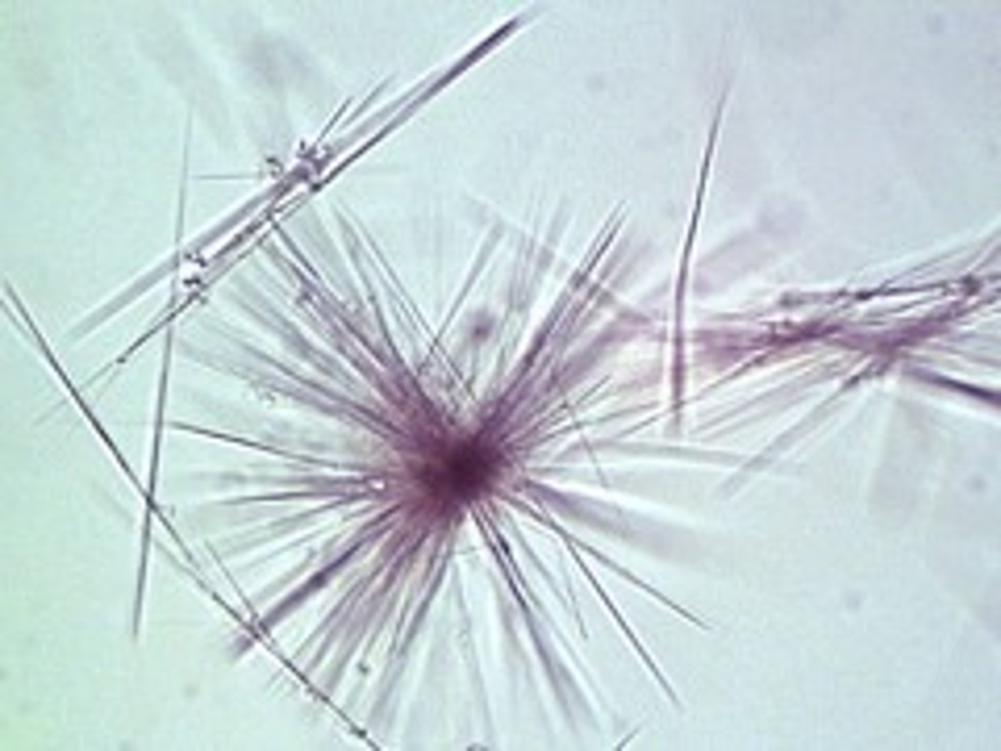 <p>Fine yellow needles in sheaves</p><p>or rosettes; Severe liver disease</p><p>Often seen with leucine.</p>